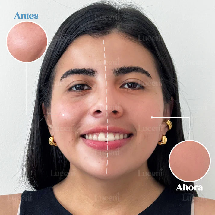 🛍️¡PROMOCIÓN ESPECIAL 2x1! | Candy Bella®🛍️| Gel pensado para control de grasa facial