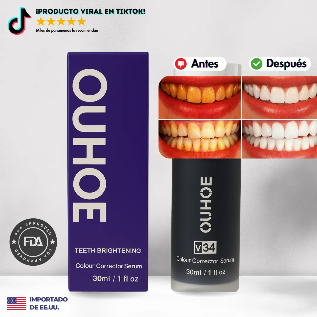 ¡Oferta! OUHOE® v34 - Blanqueamiento de nivel profesional desde casa!