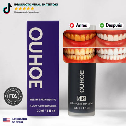 ¡Oferta! OUHOE® v34 - Blanqueamiento de nivel profesional desde casa!