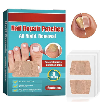 NailPure™ 32 Parches Anti Hongos Uñas ¡SUPER OFERTA 2x1!