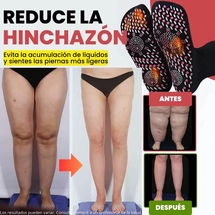 Calcetines de acupresión Anti-Varices | Oferta 2x1