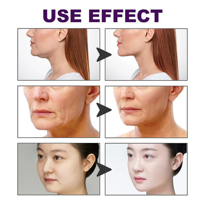 Rejuvenece Tu Rostro  | Lifting instantáneo sin cirugía